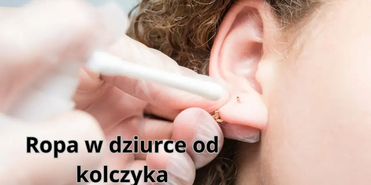 Ropa w dziurce od kolczyka. Wacik kosmetyczny usuwa wydzielinę z ucha po przekłuciu.