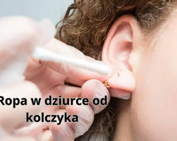 Ropa w dziurce od kolczyka. Wacik kosmetyczny usuwa wydzielinę z ucha po przekłuciu.