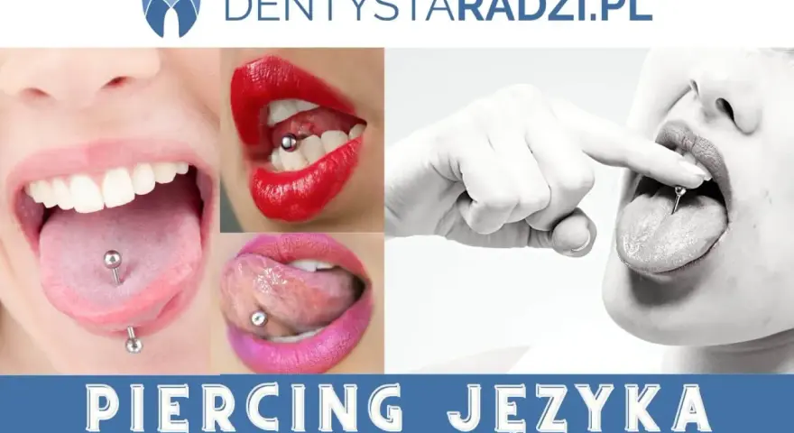 Kolczyk w języku, widoczna opuchlizna po przekłuciu. Zdjęcia pokazują różne etapy gojenia i wygląd języka z kolczykiem.