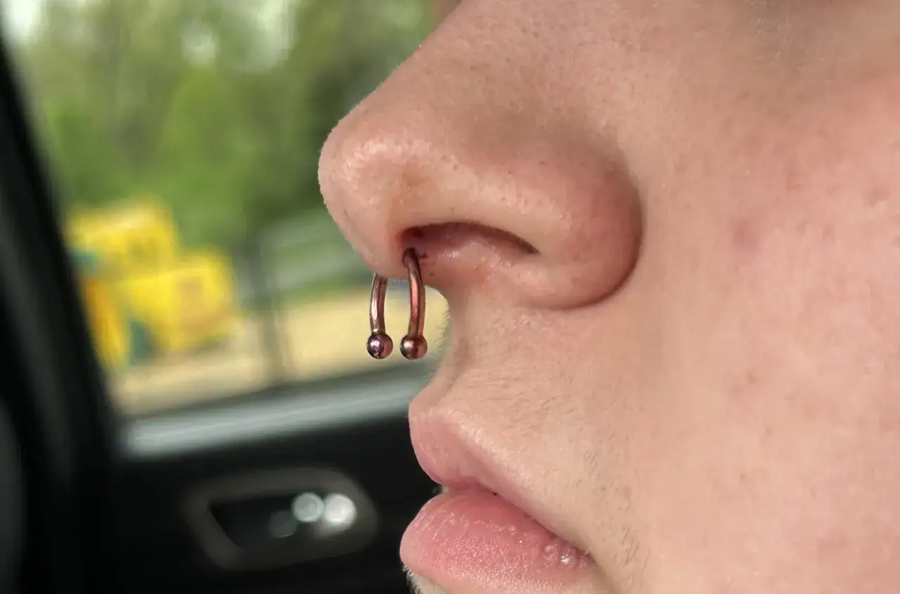 Zbliżenie na nos z kolczykiem w septum. Widać, że sk&oacute;ra wok&oacute;ł kolczyka jest lekko zaczerwieniona, co może sugerować, że septum zarasta.